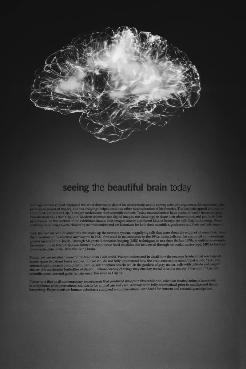 Représentation du cerveau et de la cognition liée au TDAH